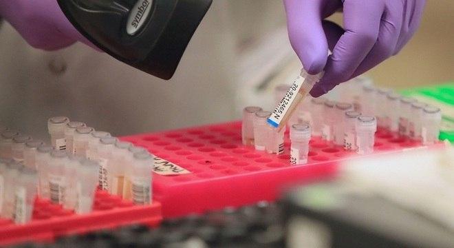 Covid-19: mortes sobem para 11 e casos confirmados chegam a 904