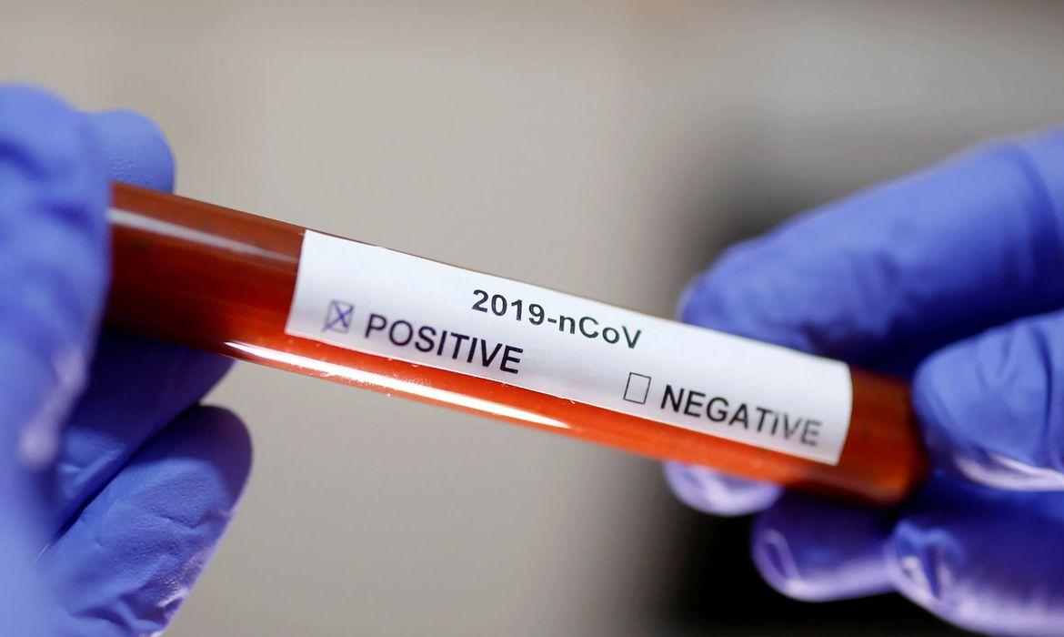 Resende confirma o primeiro caso positivo de coronavírus