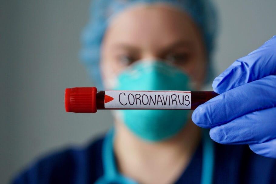Resende confirma o quinto caso positivo de coronavírus