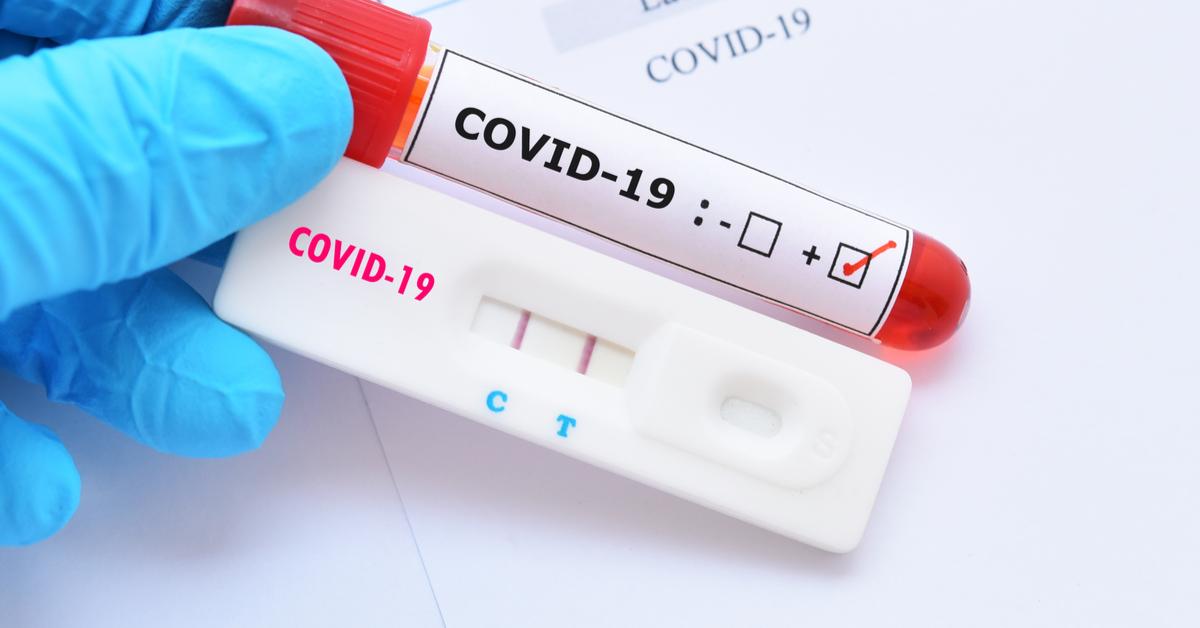Covid-19: ANS torna obrigatória cobertura de teste por planos de saúde